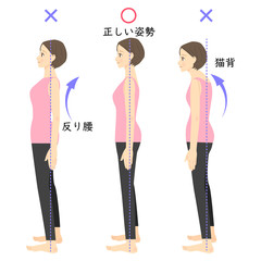 反り腰と腰痛の関係性について　新潟市中央区万代ZEROSPO-ADVANCE新潟万代